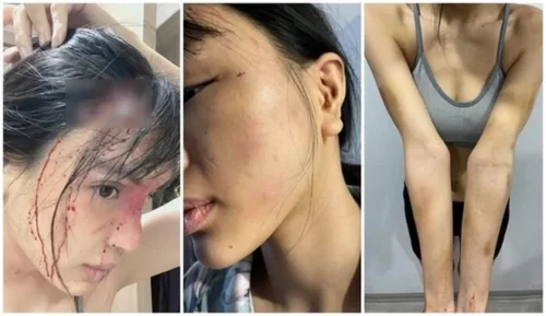 Khả Trang - Nữ siêu mẫu công khai bị bạo hành dã man